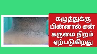 கழுத்துக்கு பின்னால் கருமை நிறம் எதனால் ஏற்படுகிறது / acanthosis nigricans .