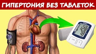 ГИПЕРТОНИЯ как Жить без Таблеток. Лечение Высокого Давления без Лекарств