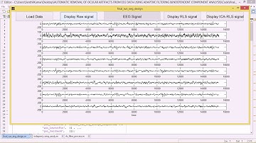 AUTOMATIC REMOVAL OF OCULAR ARTIFACTS FROM EEG DATA USING ADAPTIVE FILTERING &INDEPENDENT COMPONENT