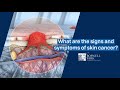 Identifying Non-Melanoma Skin Cancers Through Visual Characteristics