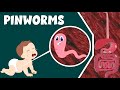 Understanding Pinworms