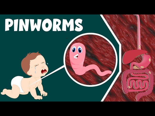Pinworm- Infection, Causes and Treatment