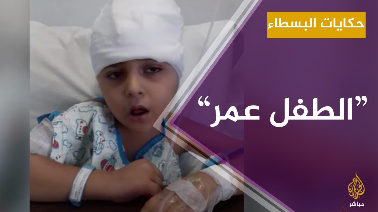 حكاية الطفل عمر المصاب بسرطان المخ