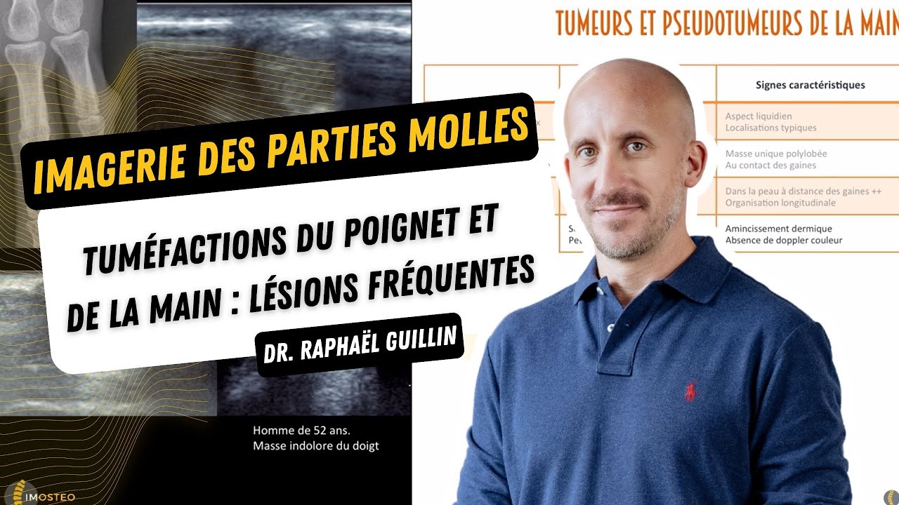 TUTORIEL IMOSTEO #8 : Tumeurs et pseudo-tumeurs de la main et du poignet