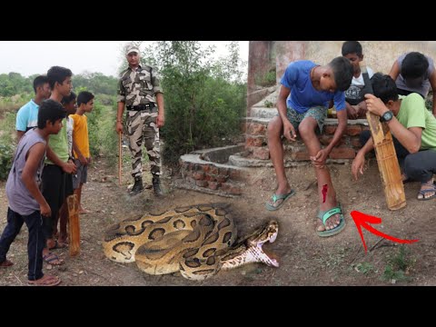 खेलते हुए बच्चे को काट लिया russells viper सांप ने😱देखिए पैर गलने लगा😨रेस्क्यू के दौरान आया police😞