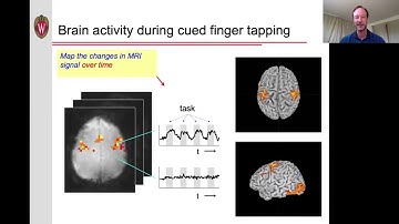 Functional MRI (fMRI) - 2: Practical & History