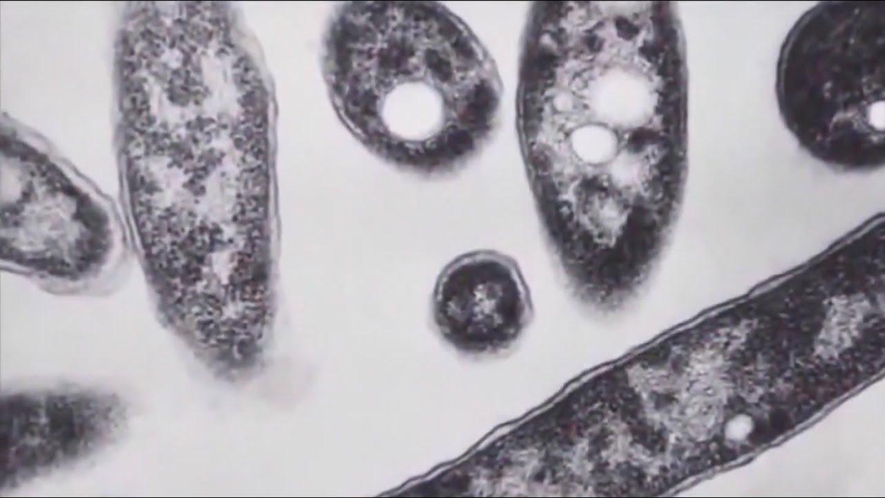 Legionnaires' Disease Transmission and Cooling Tower Contamination