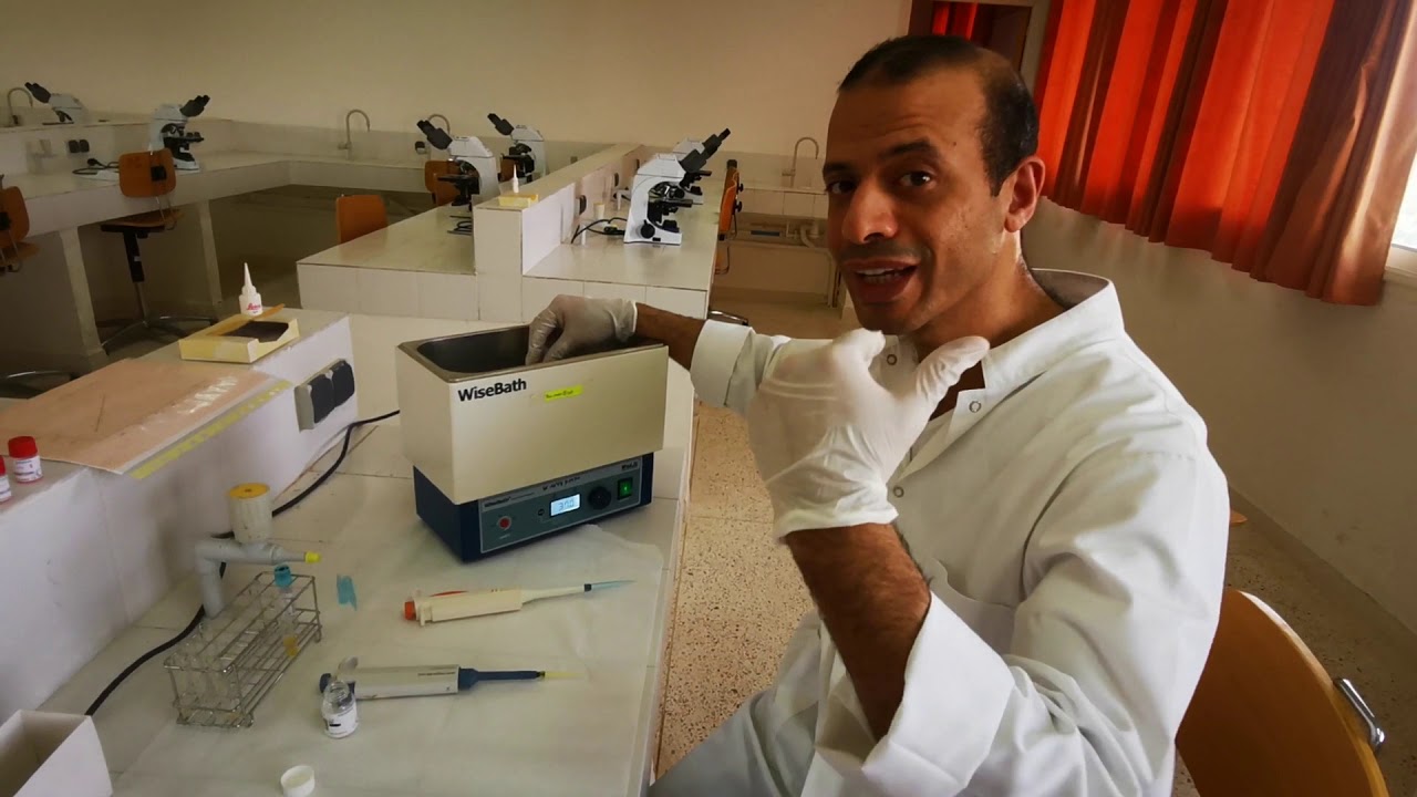 Travaux pratiques : Démonstration coagulation (TQ,TCA)