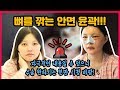 실제 안면윤곽 상담부터 수술 전과정 후기(수술고민분들 필히 꼭 영상보셔야해요!!) 안면윤곽 동시에 코성형 가능해?! 붓기 정도 통증 달라진 얼굴 ㄷㄷ [쀼]