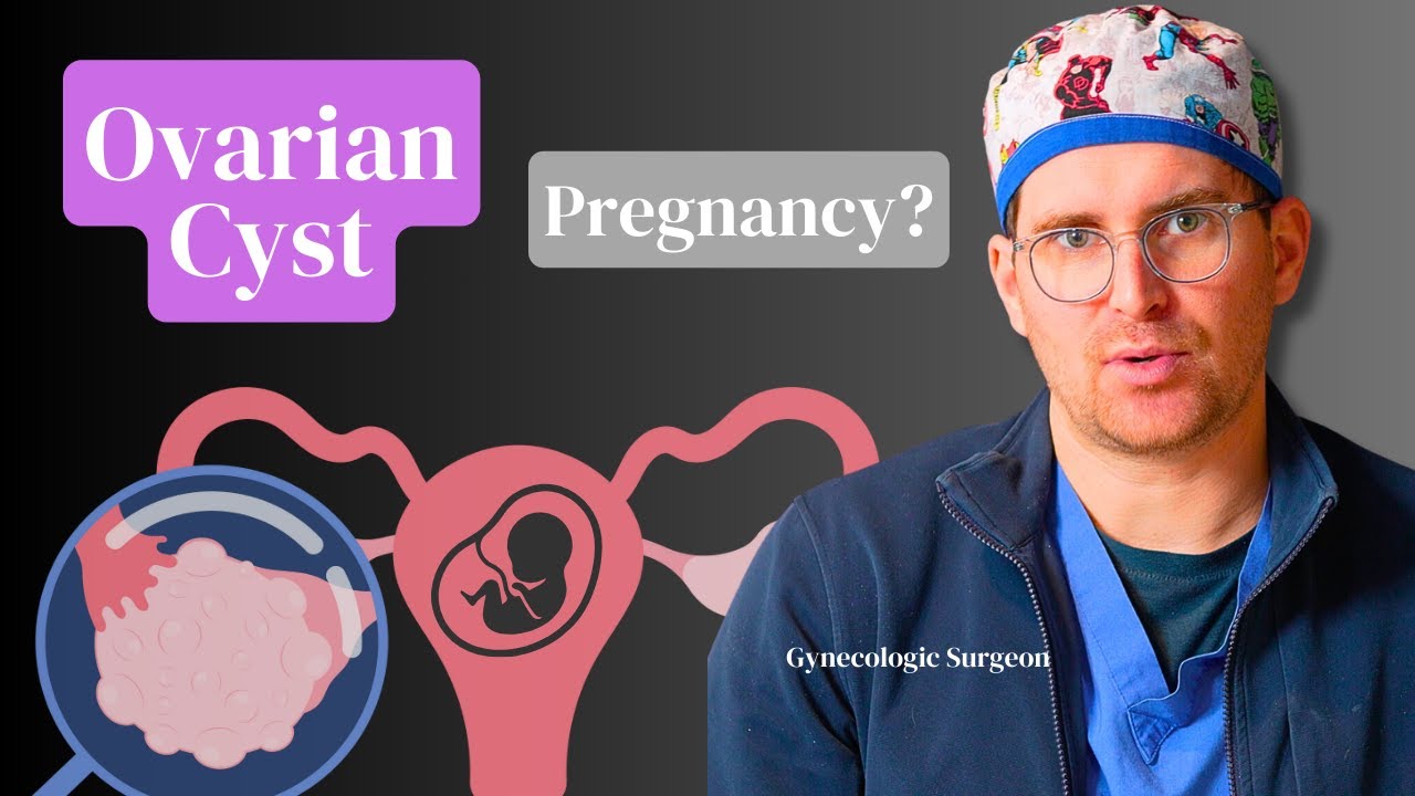 Акушер-гинеколог обсуждает: кисты яичников и беременность