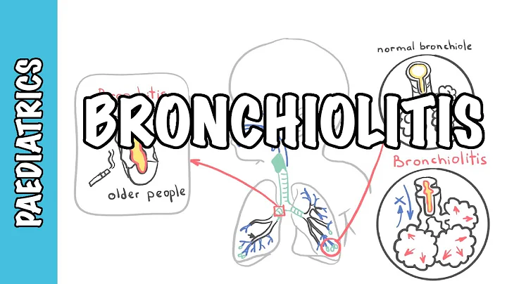 Bronchiolitis (causes, pathophysiology, signs and symptoms, treatment) - DayDayNews