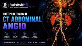 🩻 CT Abdominal Angiography ⚡ Post Processing | 🔥 3D Volume Rendering | 👨⚕️ Radiology Tutorial
