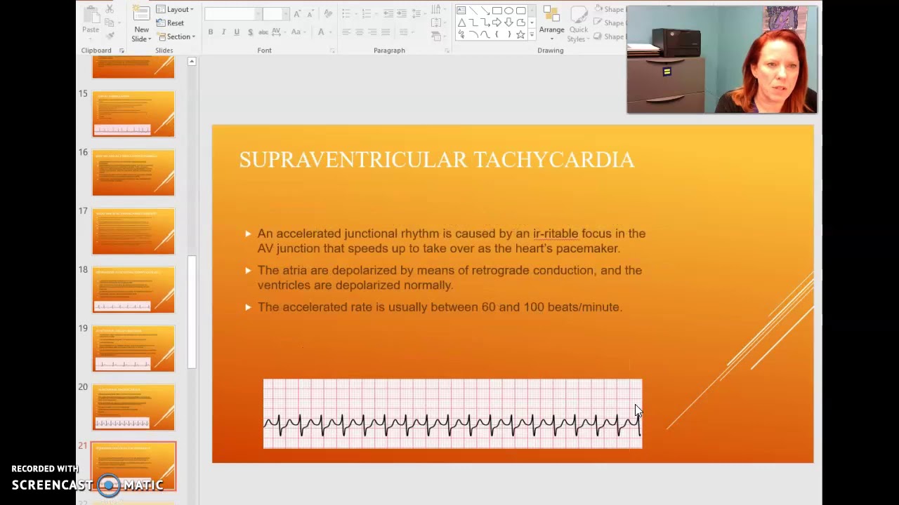 EKG Module 3 - YouTube