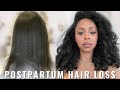 Postpartum Hair Loss Journey and how to get healthy Hair!