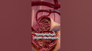 Tiểu buốt là biểu hiện của những bệnh lý nào?