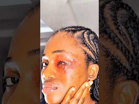 EYES INJURY SPECIAL EFFECTS MAKEUP REMOVAL    #sfxmakeupartist #okosodo #1millionviews #sfxtutorial