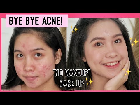 MAKE UP "WITHOUT MAKE UP" FOR ACNE PRONE SKIN! BYE-BYE JERAWAT!