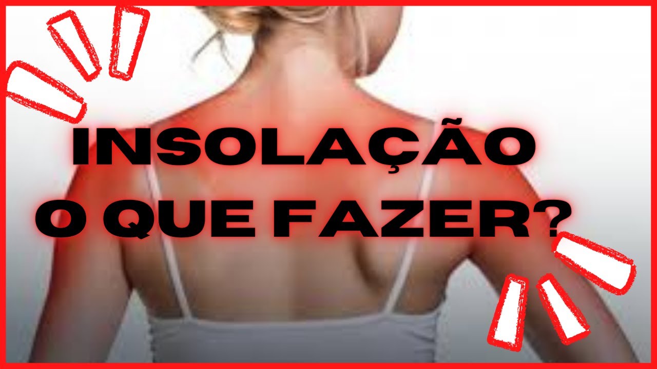 VOCÊ SABE O QUE FAZER EM CASO DE INSOLAÇÃO - YouTube