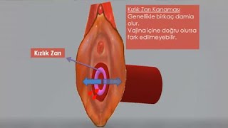 Ilk Gece Iliskide Kanama Op Dr Funda Yazici Erol