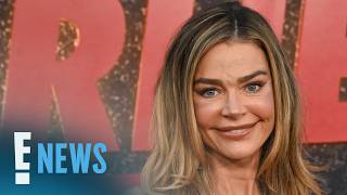 Denise Richards Details All the Plastic Surgery Procedures on Her Face | E! News