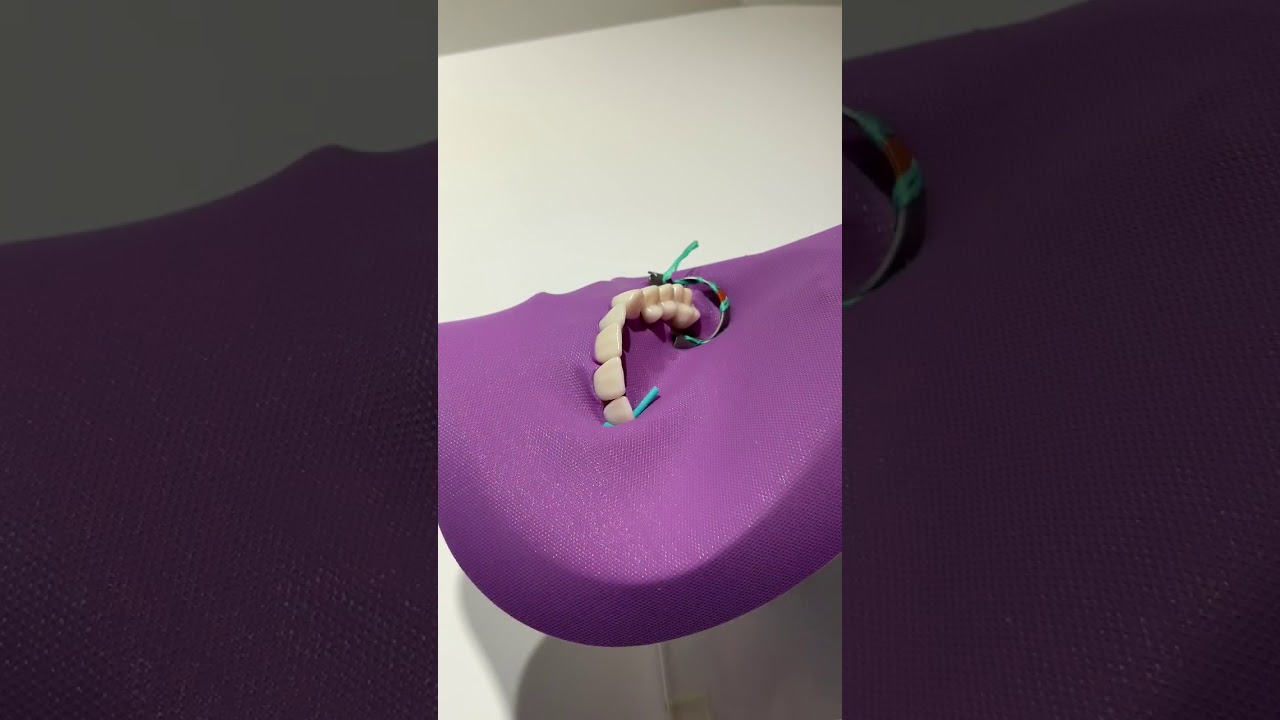 Posterior Quad Framed Flexi Dam