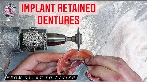 MAKING DENTURES WITH IMPLANTS #waxbae #implants