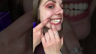 BURST teeth whitening strips review