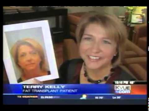 Hair Transplant News & Media