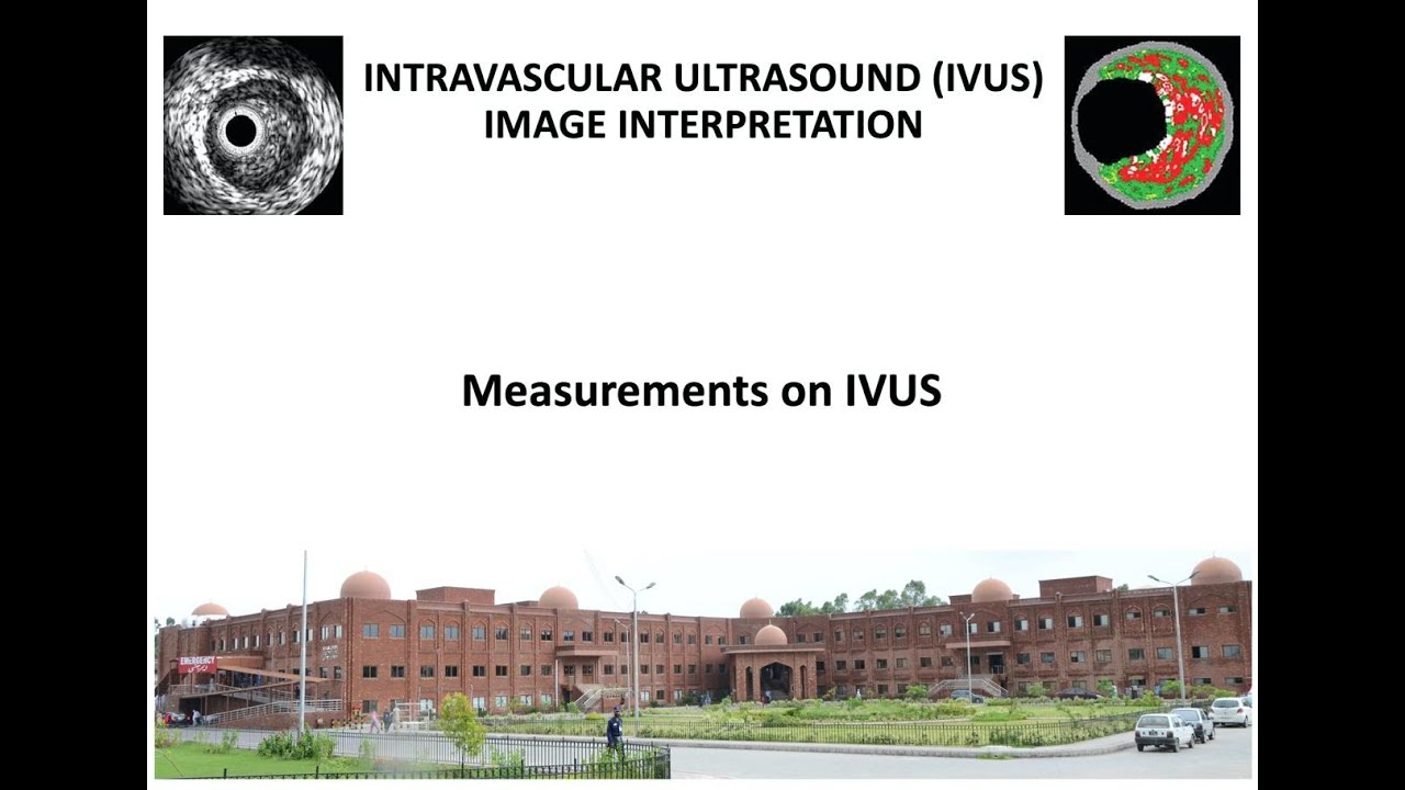 7. Measurements on IVUS