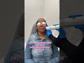 Pro tip: combine your skin treatments for best results💁🏾‍♀️ #skinpen #aerolase #skintreatments