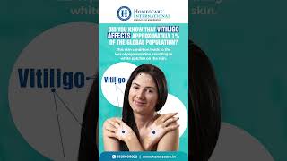 Vitiligo: Understanding This Skin Condition