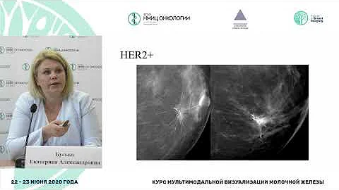 Ультразвуковая и рентгенологическая картина неинвазивного и инвазивного рака молочных желез