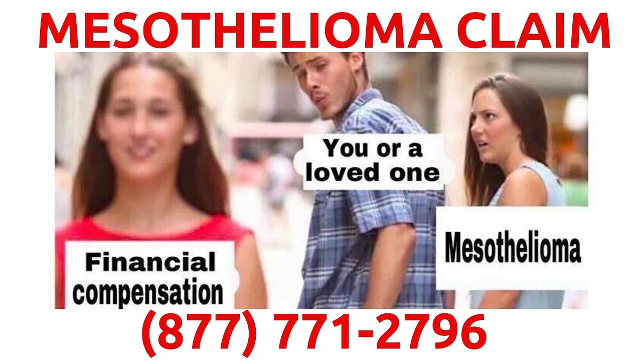 Detailed Anaheim Mesothelioma, View Illustration Detailed Anaheim Mesothelioma, View Illustration