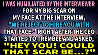 【Apple】I was humiliated by the interviewer for my big scar on my face at the interview, "We reject..