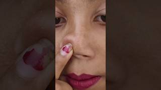 Blackhead Gone in 1 MIN 😱 Home Hack That Actually Works ✅#hack #blackheads #shorts #viralvideo