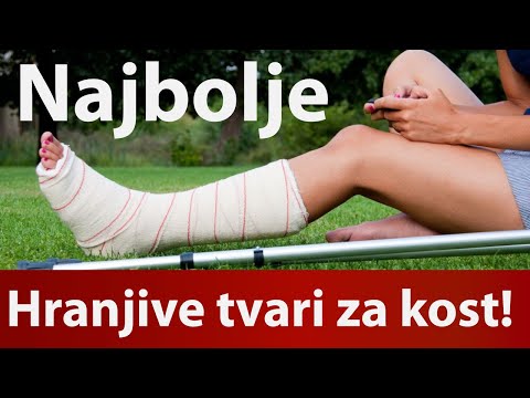 Najbolja dijeta za zacjeljivanje kostiju lom, operacija ili trauma Dr#29