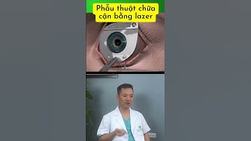 Phẫu thuật chữa cận bằng lazer #shorts