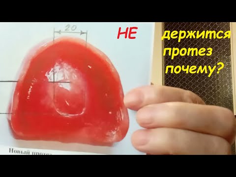 Ошибка стоматолога или преднамеренный брак? Из личного опыта. Опыт Куликова.