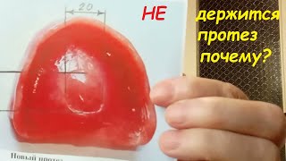 Ошибка стоматолога или преднамеренный брак? Из личного опыта. Опыт Куликова.