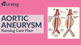 Nursing Care Plan for Aortic Aneurysm (Nursing Care Plan)