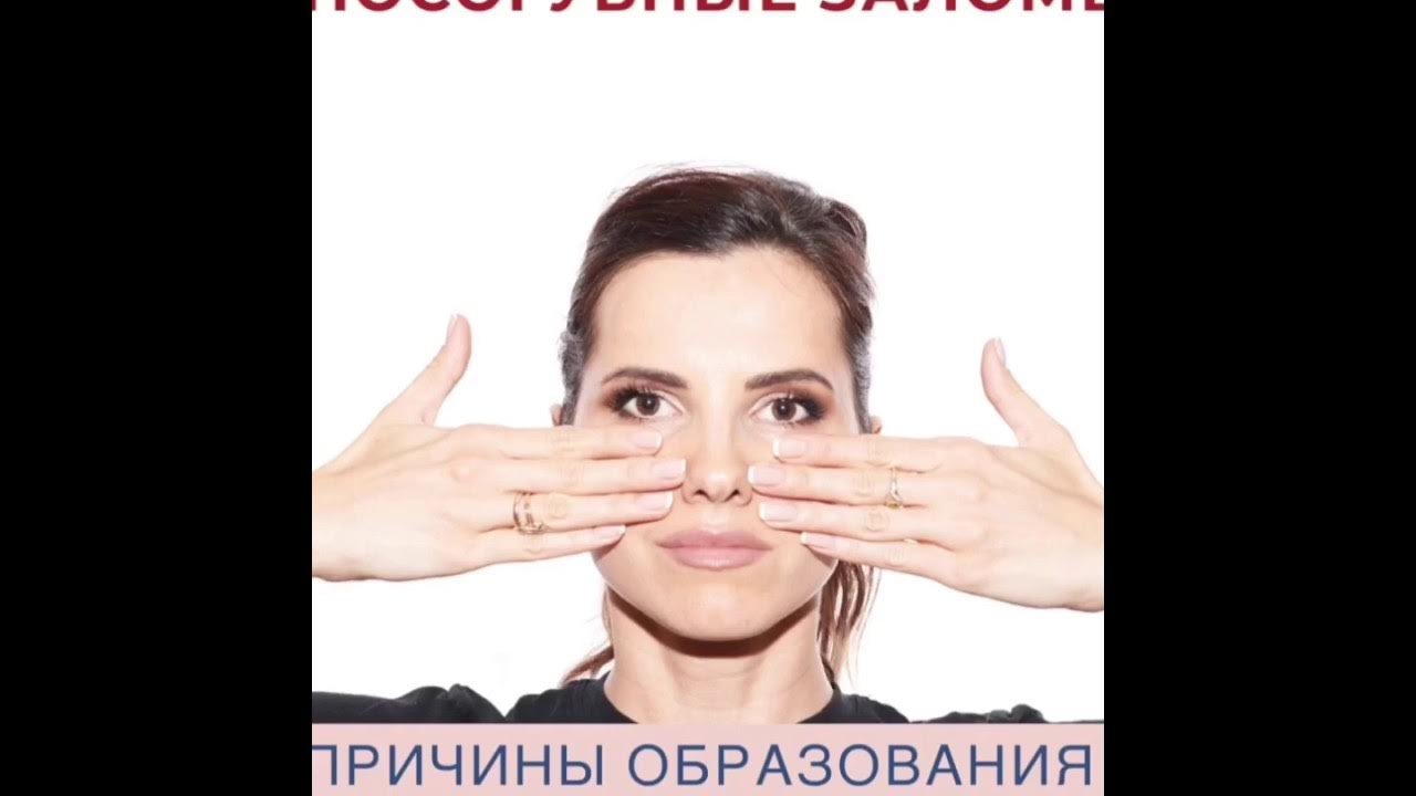 Носогубки и причины их образования - YouTube