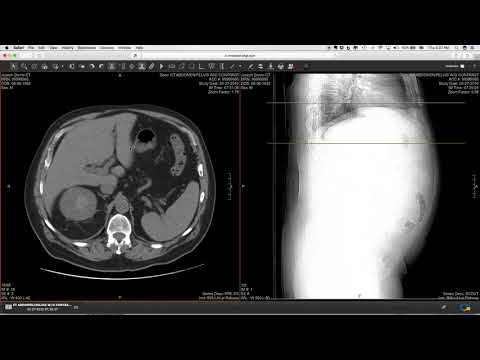 myBaystateHealth Patient Portal - My Radiology Results Image Viewer