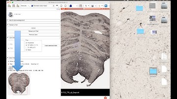 Zooming into microscopy data using 3D Slicer