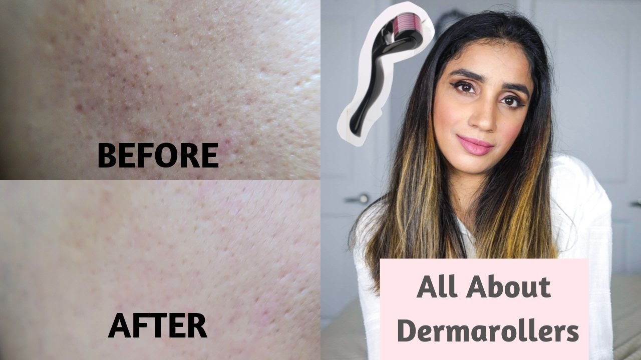 At Home Derma Roller - How To Use It