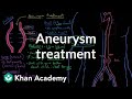 Aneurysm treatment | Circulatory System and Disease | NCLEX-RN | Khan Academy