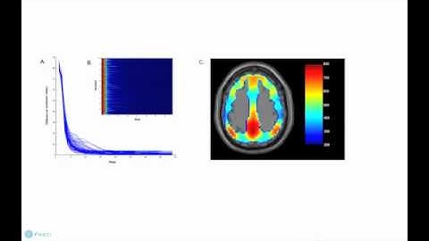Dynamical Stability of Intrinsic Connectivity Networks