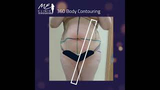 نحت الجسم 360 مع شد ترهلات البطن 360 body contouring with Tummy tuck