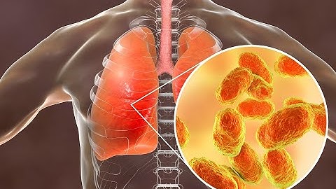 Pneumonia detection using Deep Learning