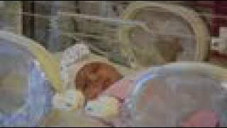 Akciğerlerinde hava kaçağı oluşan Derin bebek tüple hayata tutundu Resimi