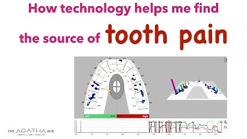TScan Technology helps determine Angela